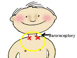 Sposb nawietlania problemw z cinieniem Q.Light