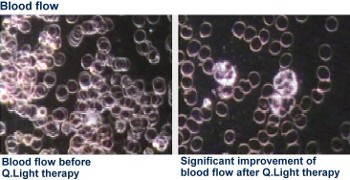 Efekt nawietlania Q.Light
