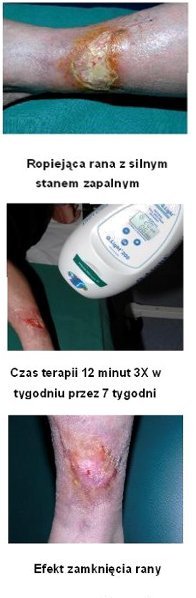 Efekty nawietlania Q.Light